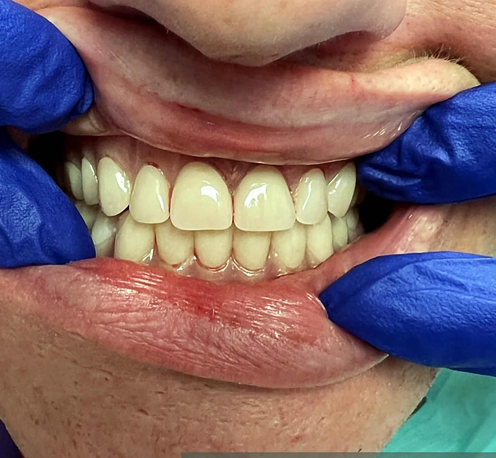 Case 01, after