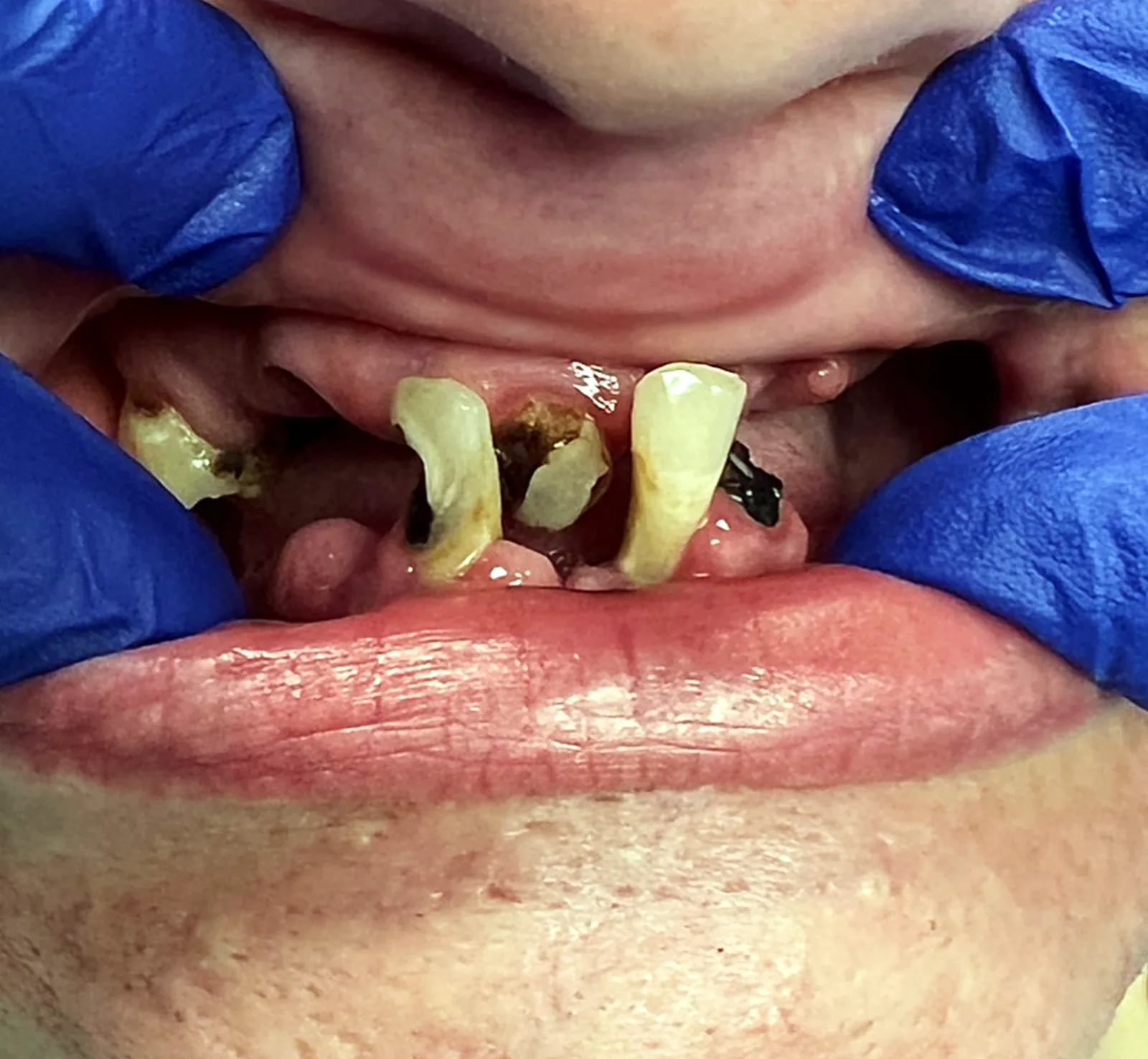 Case 01, before