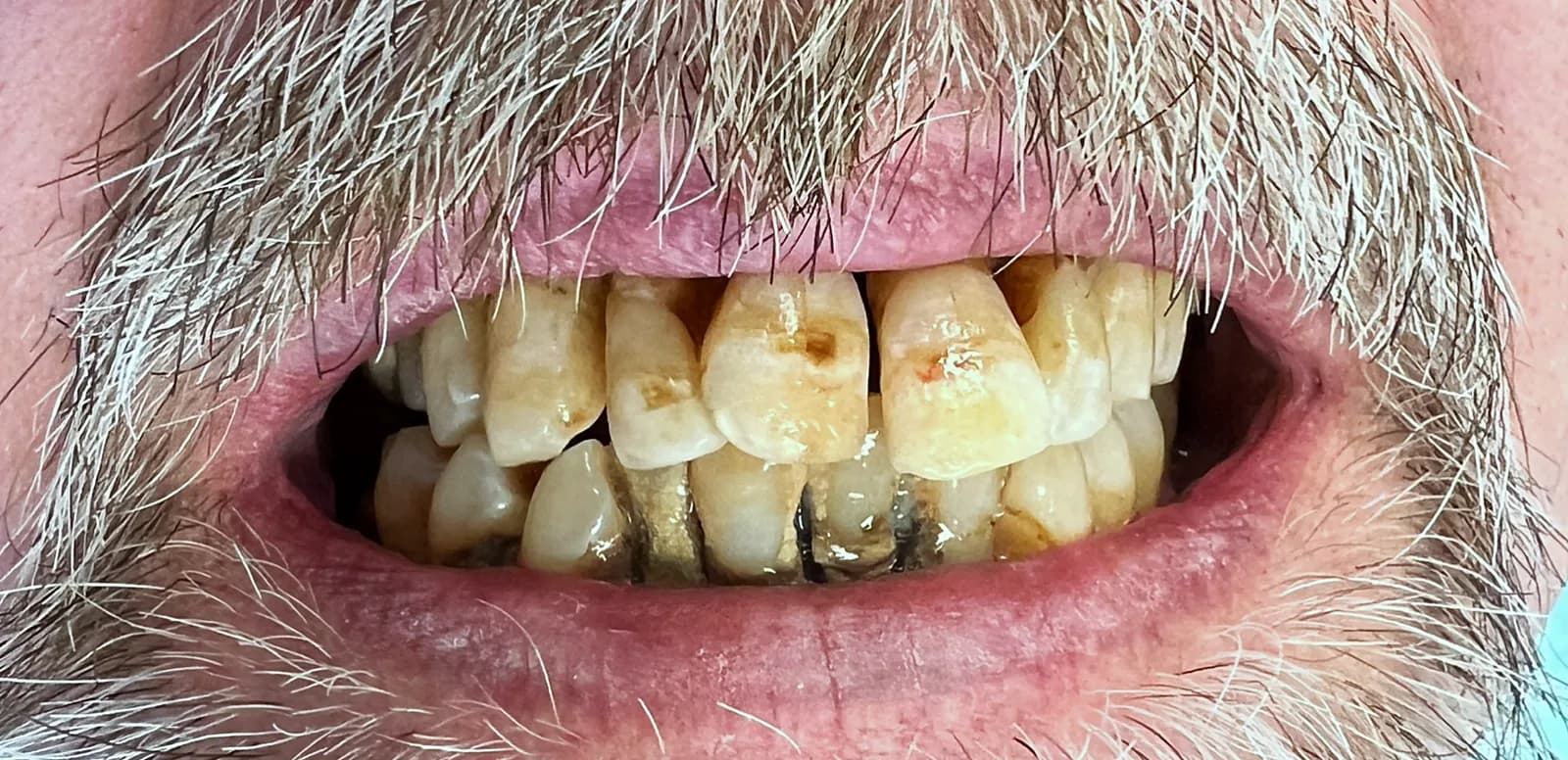 Case 03, before