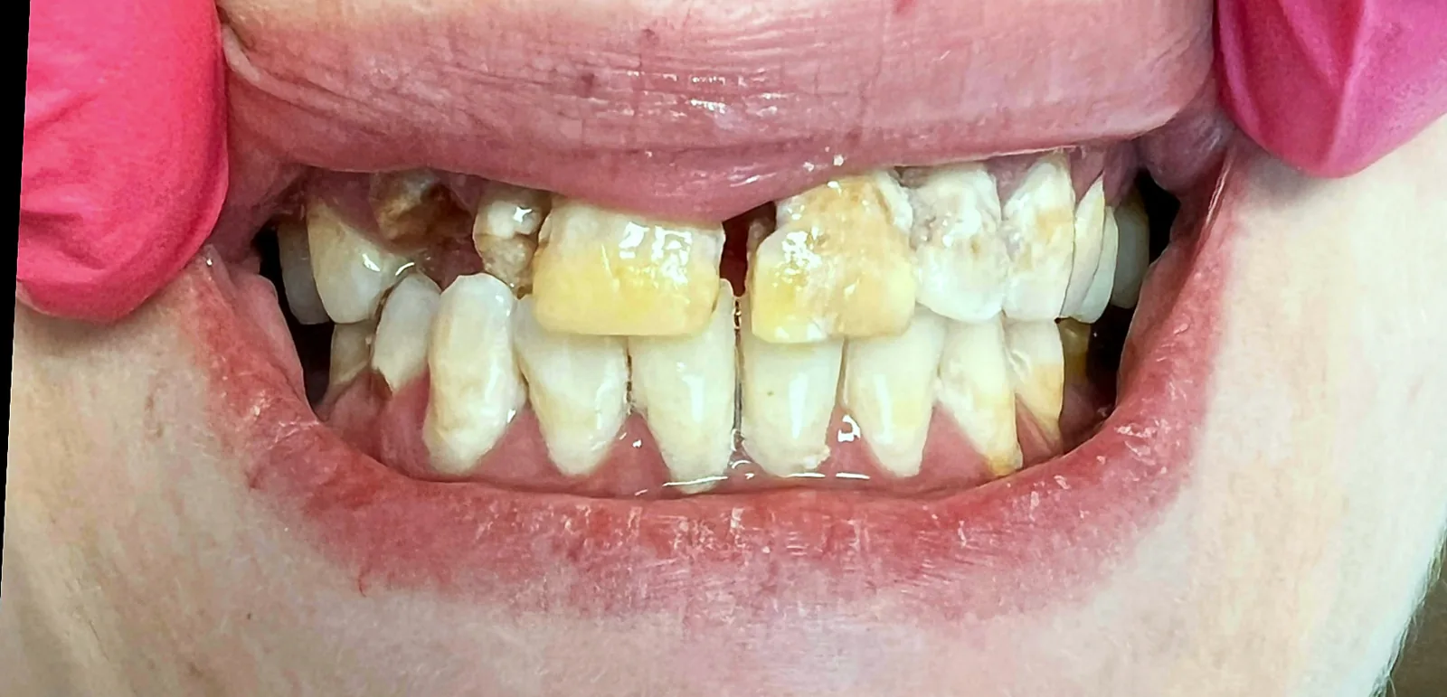 Case 04, before