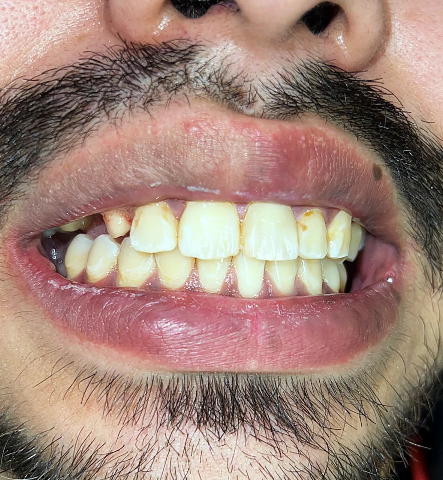Case 06, before