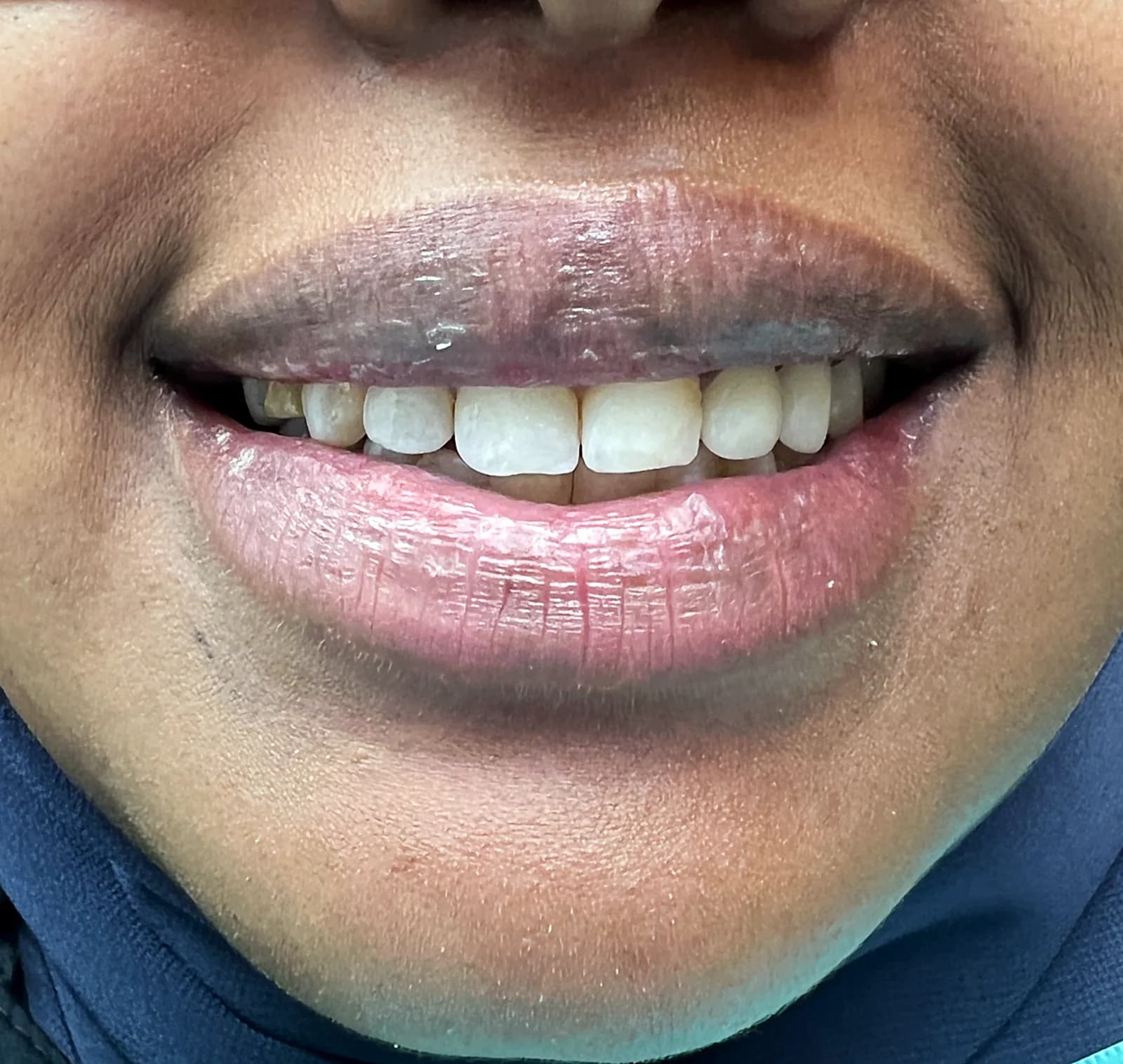 Case 07, after