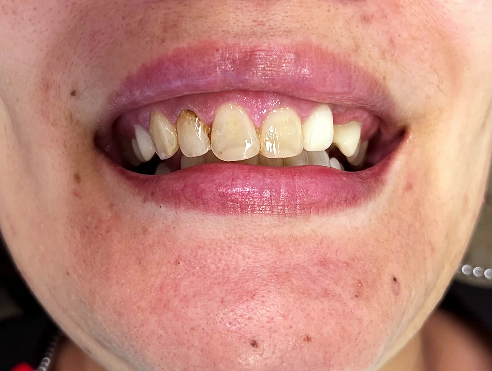 Case 09, before