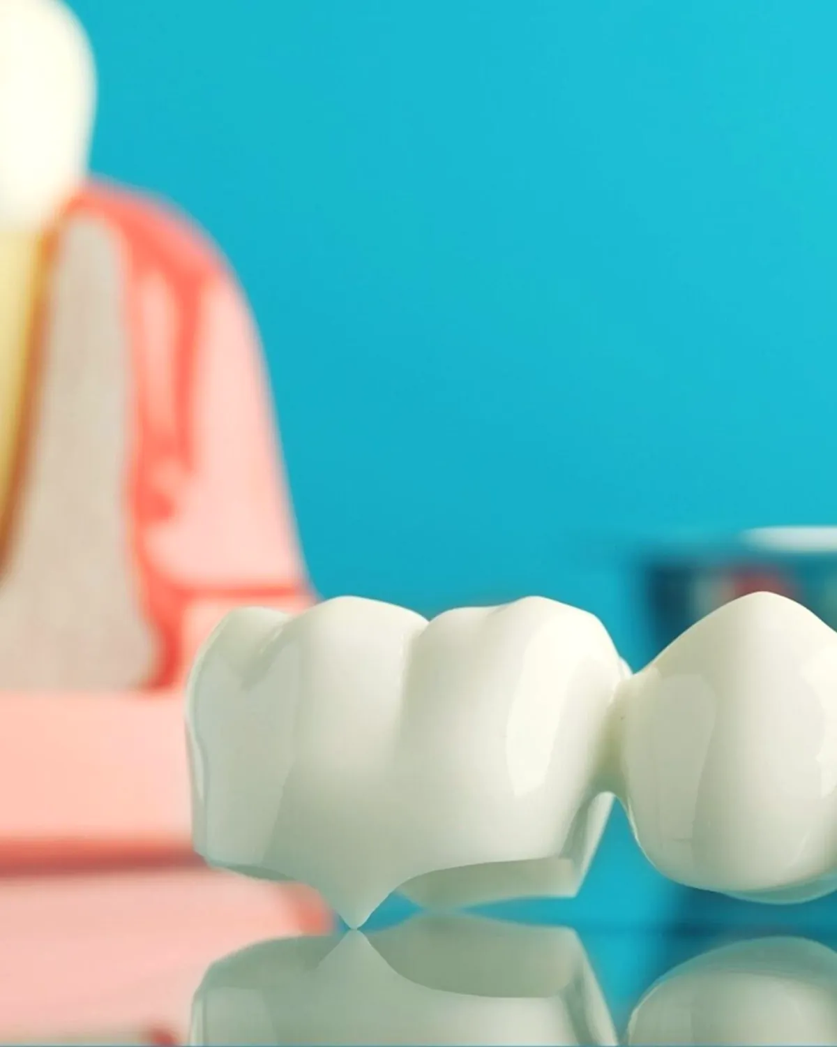 A three-tooth dental bridge on a reflective surface