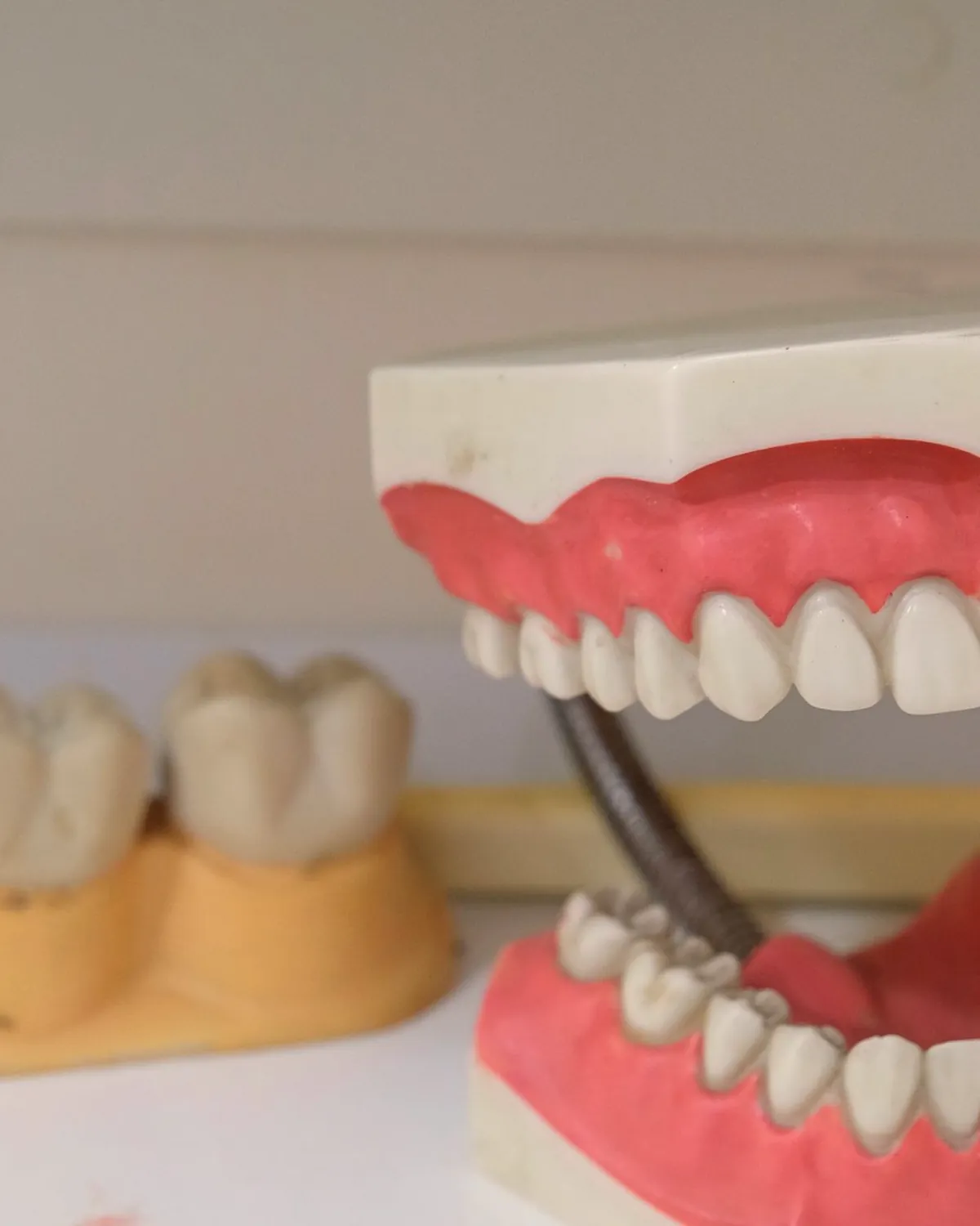 A full denture model with upper and lower teeth
