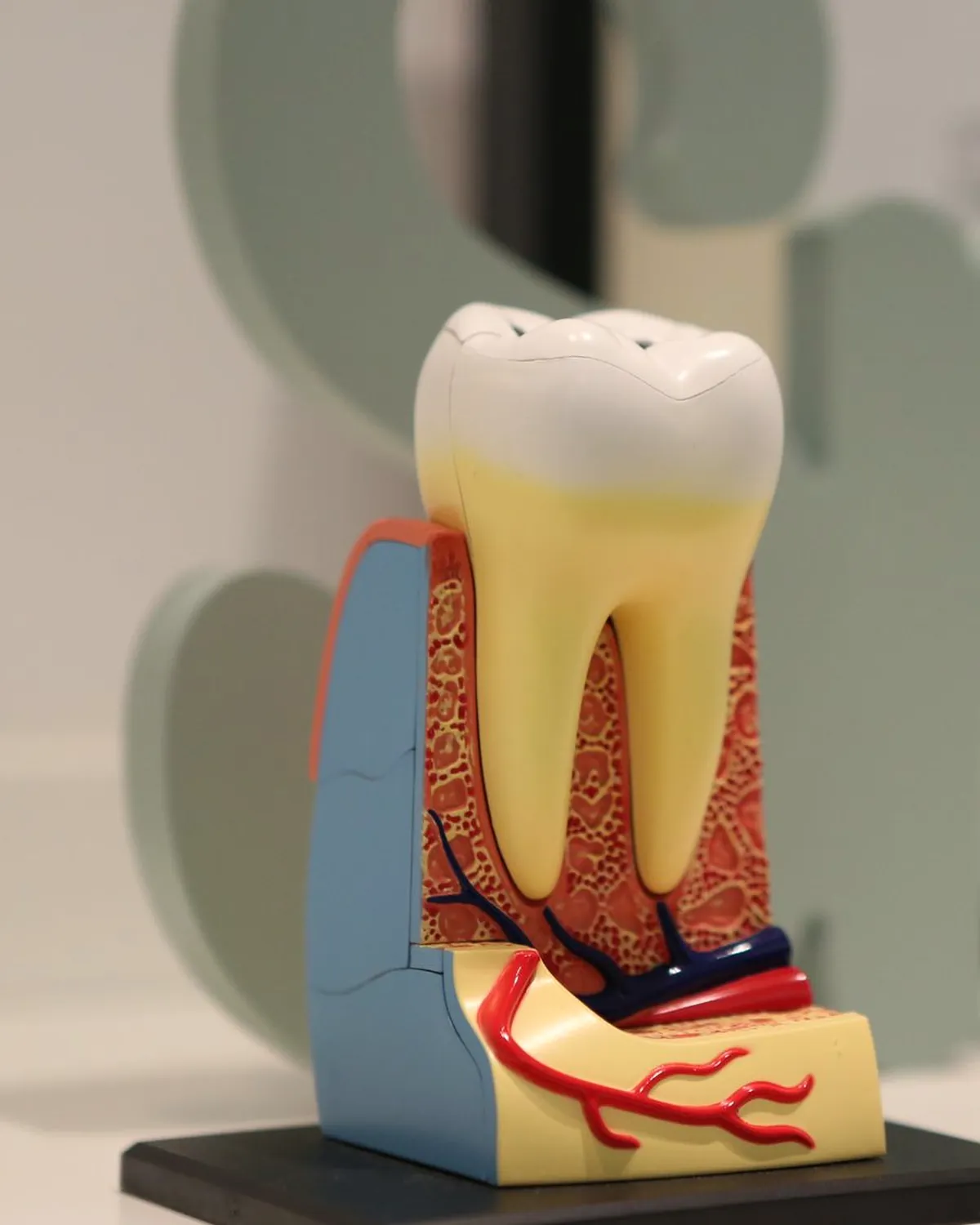 A cross-section model of a molar showing the root canals and nerve